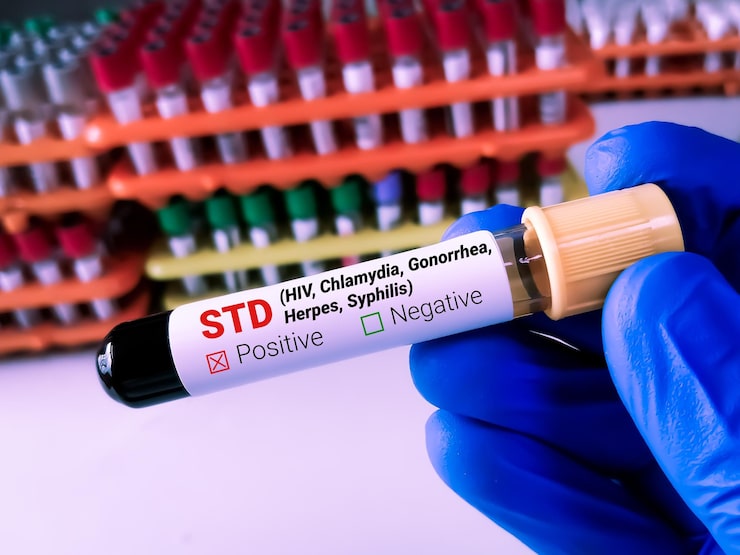STD screening and treatment